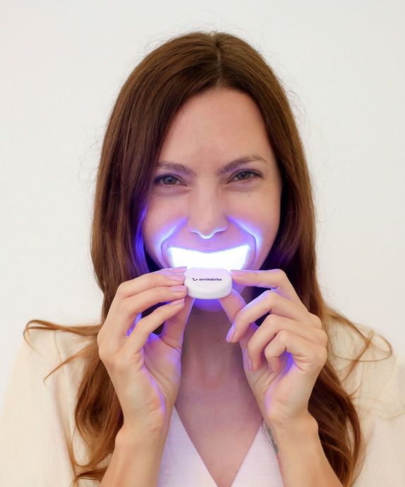 BLANQUEADOR DENTAL - TRANSFORMA TU SONRISA HOY MISMO EN 20 MINUTOS