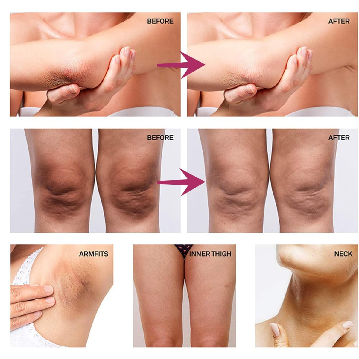 CREMA BLANQUEDORA ¡ACLARE SUS AXILAS, CODOS, CUELLO, RODILLAS ETC!!
